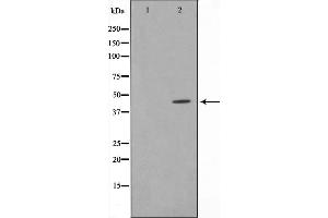 Western blot analysis on HeLa cell lysate using IRF4 Antibody，The lane on the left is treated with the antigen-specific peptide. (IRF4 抗体  (C-Term))