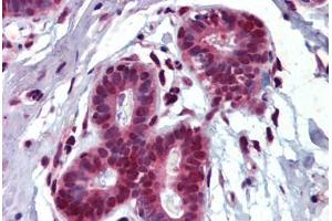 Breast, Human: Formalin-Fixed, Paraffin-Embedded (FFPE) (THRSP 抗体)