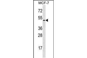 Western blot analysis in MCF-7 cell line lysates (35ug/lane). (Ladinin 1 抗体  (N-Term))