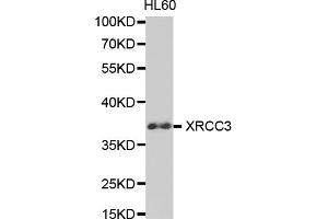 Western blot analysis of extracts of HL-60 cells, using XRCC3 antibody (ABIN5971161) at 1/1000 dilution. (XRCC3 抗体)