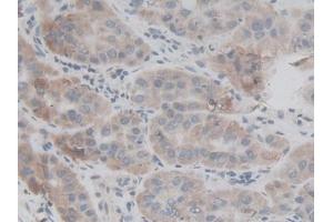 Used in DAB staining on fromalin fixed paraffin- embedded kidney tissue (FAM132A 抗体  (AA 92-241))