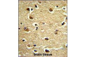 Formalin-fixed and paraffin-embedded human brain tissue reacted with CROT Antibody (N-term), which was peroxidase-conjugated to the secondary antibody, followed by DAB staining. (CROT 抗体  (N-Term))