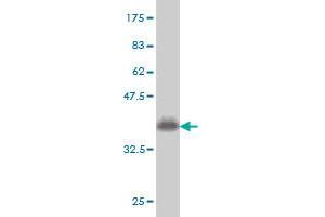 Western Blot detection against Immunogen (36. (COQ8A 抗体  (AA 1-100))