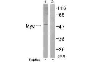 Image no. 1 for anti-Myc Proto-Oncogene protein (MYC) (Ser373) antibody (ABIN197159) (c-MYC 抗体  (Ser373))