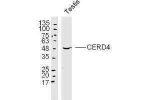 Mouse testis lysates probed with CERD4 Polyclonal Antibody, Unconjugated  at 1:300 dilution and 4˚C overnight incubation. (DPF3 抗体  (AA 1-100))