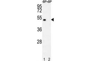 Western blot analysis of E2F1 antibody pre-incubated without (lane 1) and with (2) blocking peptide in 293T lysate. (E2F1 抗体  (AA 342-371))