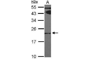 WB Image Sample (30 ug of whole cell lysate) A: NIH-3T3 12% SDS PAGE antibody diluted at 1:1000 (FTL 抗体)