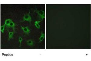 Immunofluorescence analysis of COS-7 cells, using ADRB2 polyclonal antibody . (beta 2 Adrenergic Receptor 抗体)