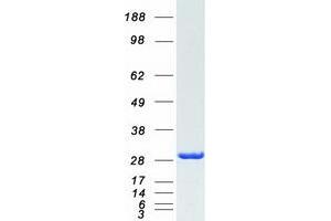 Western Blotting (WB) image for FK506 Binding Protein 3, 25kDa (FKBP3) protein (Myc-DYKDDDDK Tag) (ABIN2721213)