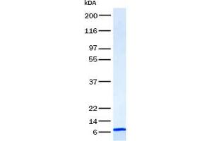 Validation with Western Blot (CXCL10 蛋白)
