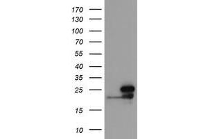 Image no. 1 for anti-NADH Dehydrogenase (Ubiquinone) 1 beta Subcomplex, 10, 22kDa (NDUFB10) antibody (ABIN1499671)