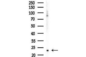 Western blot analysis of lysates from COLO205 cells, using NOL Antibody at 1/1000 dilution.
