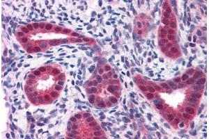 Human Uterus: Formalin-Fixed, Paraffin-Embedded (FFPE) (BUB1B 抗体  (AA 274-525))