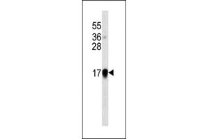 Interferon-alpha western blot analysis in IFN cell line lysates (35 μg/lane). (IFNA 抗体)