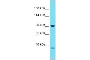 Host: Rabbit Target Name: HKDC1 Sample Type: 293T Whole Cell lysates Antibody Dilution: 1. (HKDC1 抗体  (C-Term))