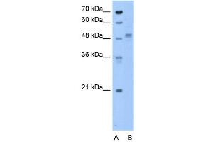 ZP4 antibody used at 0. (ZP4 抗体  (N-Term))