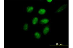 Immunofluorescence of purified MaxPab antibody to EED on HeLa cell. (EED 抗体  (AA 1-441))