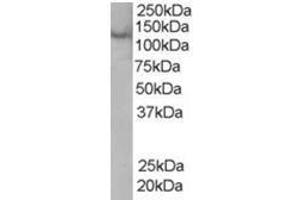 Image no. 1 for anti-Zinc Finger, FYVE Domain Containing 20 (ZFYVE20) (C-Term) antibody (ABIN374348) (Rabenosyn 5 抗体  (C-Term))