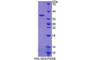 SDS-PAGE analysis of Human ERLIN2 Protein. (ERLIN2 蛋白)