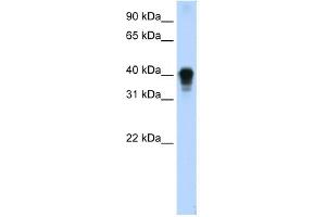 WB Suggested Anti-TIA1 Antibody Titration:  0. (TIA1 抗体  (C-Term))