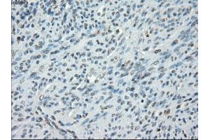 Immunohistochemical staining of paraffin-embedded colon tissue using anti-PRKAR1Amouse monoclonal antibody. (PRKAR1A 抗体)