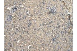 DAB staining on IHC-P; Samples: Mouse Kidney Tissue (BNP 抗体  (AA 77-121))