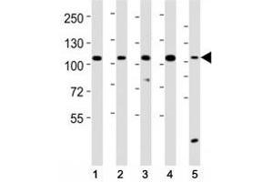 Western blot testing of LGR-5 antibody at 1:2000 dilution. (LGR5 抗体  (AA 689-719))