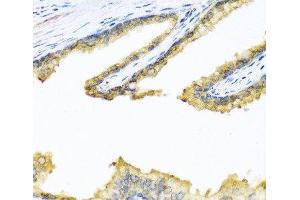 Immunohistochemistry of paraffin-embedded Human prostate using PENK Polyclonal Antibody at dilution of 1:100 (40x lens). (Enkephalin 抗体)