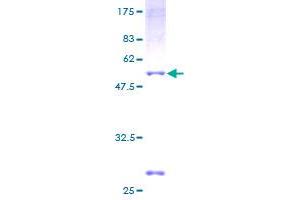 Image no. 1 for NME/NM23 Family Member 5 (NME5) (AA 1-212) protein (GST tag) (ABIN1312698) (NME5 Protein (AA 1-212) (GST tag))