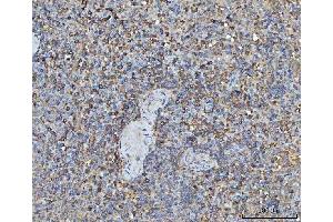 IHC analysis of TRMT61B using anti-TRMT61B antibody (ABIN7602334). (TRMT61B 抗体  (AA 7-477))