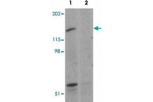 Western blot analysis of SYNPO2 in human skeletal muscle tissue lysate with SYNPO2 polyclonal antibody  at 1 ug/mL in (1) the absence and (2) the presence of blocking peptide. (SYNPO2 抗体  (N-Term))