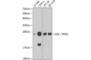 Western blot analysis of extracts of various cell lines using ASC / TMS1 Polyclonal Antibody. (PYCARD 抗体)