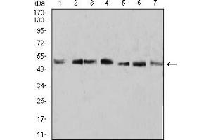 Western Blotting (WB) image for anti-Kruppel-Like Factor 2 (Lung) (KLF2) (AA 251-355) antibody (ABIN5907449) (KLF2 抗体  (AA 251-355))