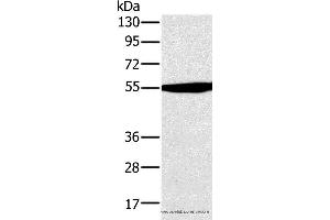 Western blot analysis of Hela cell , using OXCT1 Polyclonal Antibody at dilution of 1:300 (OXCT1 抗体)