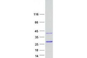 Western Blotting (WB) image for NK3 Homeobox 2 (NKX3-2) protein (Myc-DYKDDDDK Tag) (ABIN2715150)