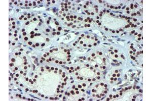 Image no. 13 for anti-Ubiquitin Specific Peptidase 7 (Herpes Virus-Associated) (USP7) antibody (ABIN1498592) (USP7 抗体)