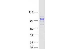Western Blotting (WB) image for Adenylate Kinase 5 (AK5) (Transcript Variant 2) protein (Myc-DYKDDDDK Tag) (ABIN2714406)