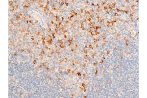 ABIN6267219 at 1/100 staining mouse spleen tissue sections by IHC-P. (NFKBIE 抗体  (pSer161))