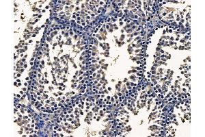 ABIN7095163 and ABIN7099219 at 1/100 staining mouse testis tissue by IHC-P. (METRN 抗体)