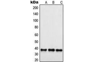 Western blot analysis of SAE1 expression in Jurkat (A), A431 (B), HeLa (C) whole cell lysates.