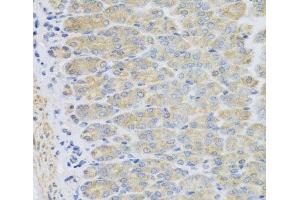 Immunohistochemistry of paraffin-embedded Mouse stomach using EFHC1 Polyclonal Antibody at dilution of 1:100 (40x lens). (EFHC1 抗体)