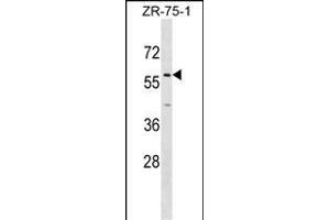 ZNF10 Antibody (N-term) (ABIN1538984 and ABIN2849102) western blot analysis in ZR-75-1 cell line lysates (35 μg/lane). (ZNF10 抗体  (N-Term))