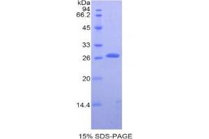 SDS-PAGE analysis of Human Transferrin Receptor Protein. (Transferrin Receptor 蛋白)