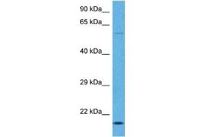 Host:  Rabbit  Target Name:  TNNI1  Sample Tissue:  Human Ovary Tumor  Antibody Dilution:  1ug/ml (TNNI1 抗体  (N-Term))