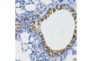 Immunohistochemistry (IHC) image for anti-IQ Motif Containing GTPase Activating Protein 1 (IQGAP1) (AA 500-750) antibody (ABIN7268020)