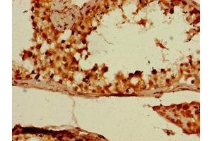 Immunohistochemistry of paraffin-embedded human testis tissue using ABIN7149640 at dilution of 1:100 (DAZL 抗体  (AA 130-250))