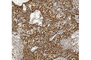 IHC analysis of MTTP using anti-MTTP antibody (ABIN7601145). (MTTP 抗体  (AA 29-702))