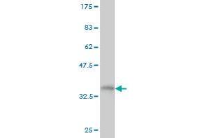 Western Blotting (WB) image for anti-Ring Finger Protein 141 (RNF141) (AA 141-229) antibody (ABIN565506)