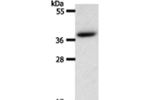 Western Blot analysis of Hela cell using AKR1B1 Polyclonal Antibody at dilution of 1:550 (AKR1B1 抗体)