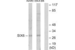 Western blot analysis of extracts from HuvEc/COLO205 cells, using SIX6 Antibody. (SIX Homeobox 6 抗体  (AA 121-170))